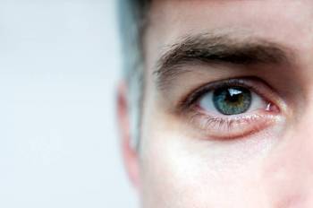 Augen brennen